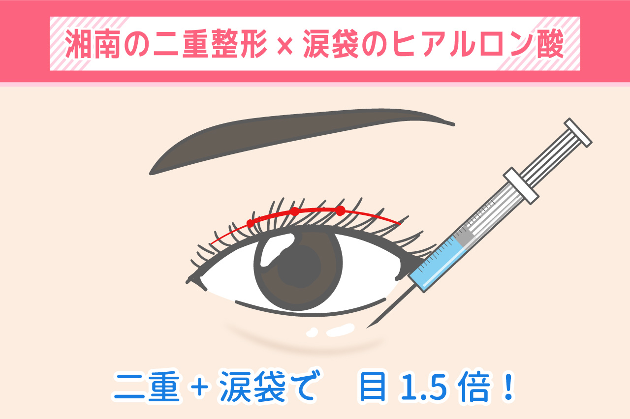 湘南の二重整形×涙袋のヒアルロン酸